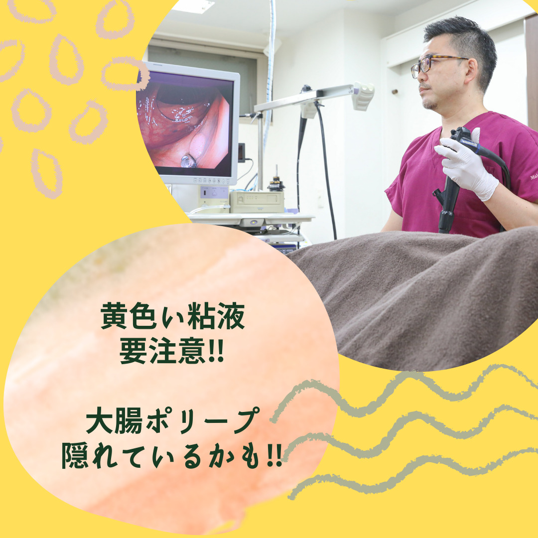 黄色い粘膜が付いている大腸ポリープに要注意‼